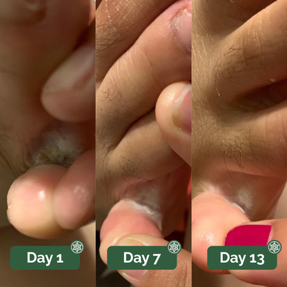Veloma® Antifungal Soap