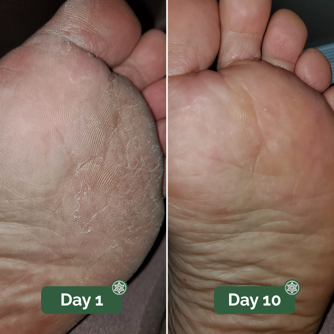 Veloma® Antifungal Soap