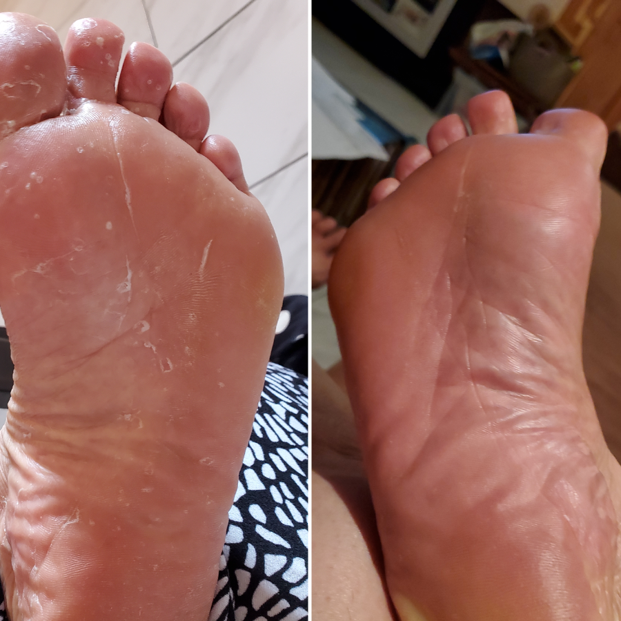 Veloma® Antifungal Soap